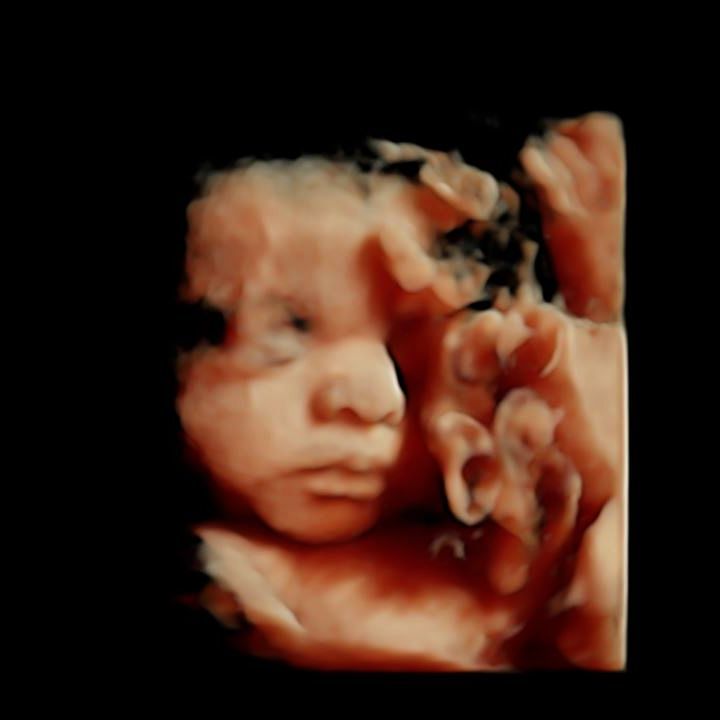  3D ultrasound photos @ 31weeks  